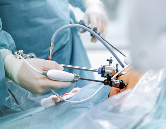 Bariatric Surgery