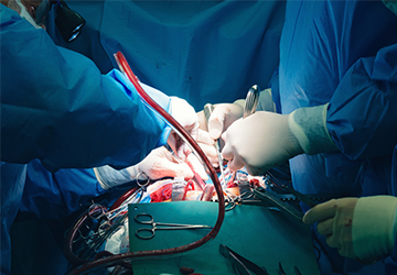 Cardiovascular and Thoracic Surgery