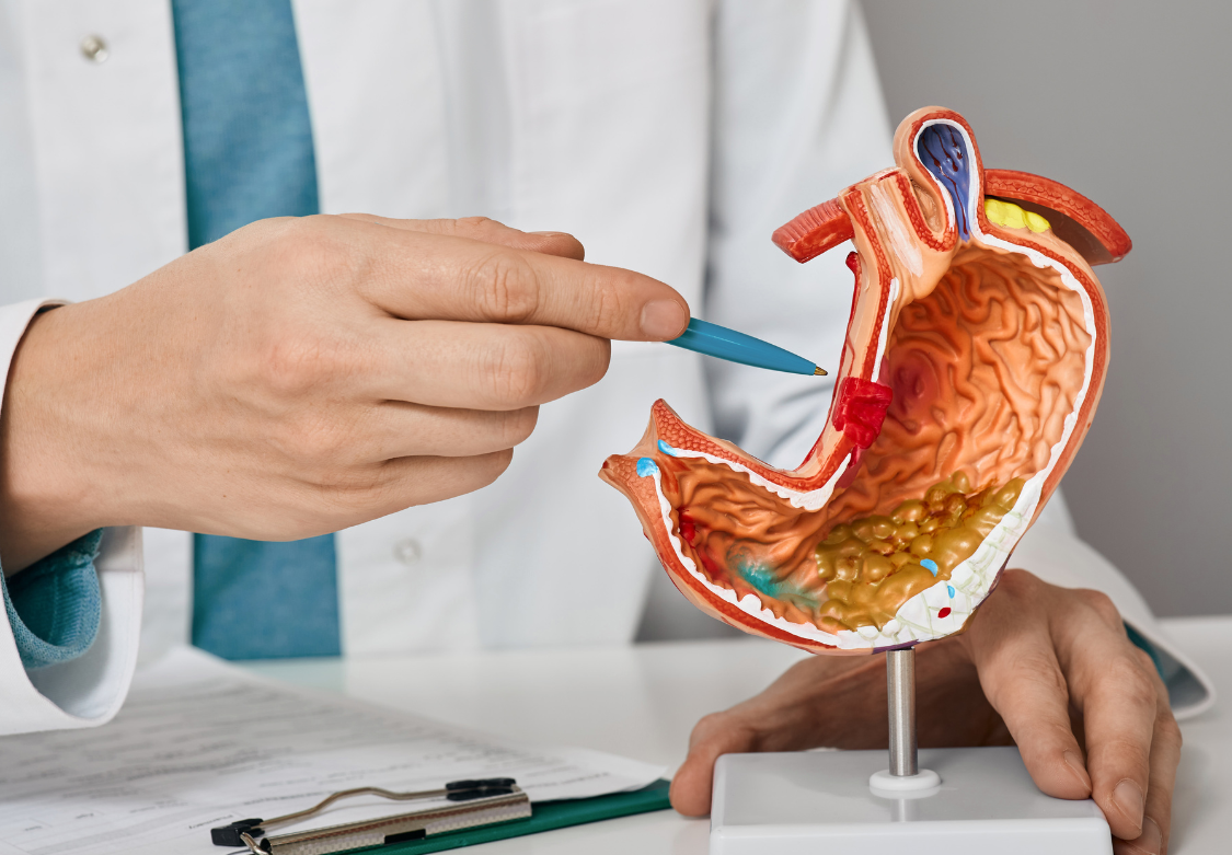 Gastro Surgery