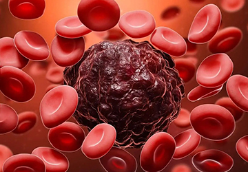 Hemato Oncology