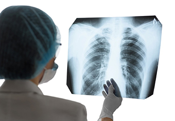 Interventional Pulmonology