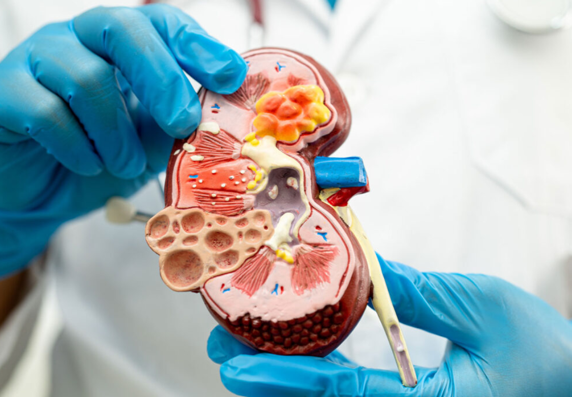 Nephrology