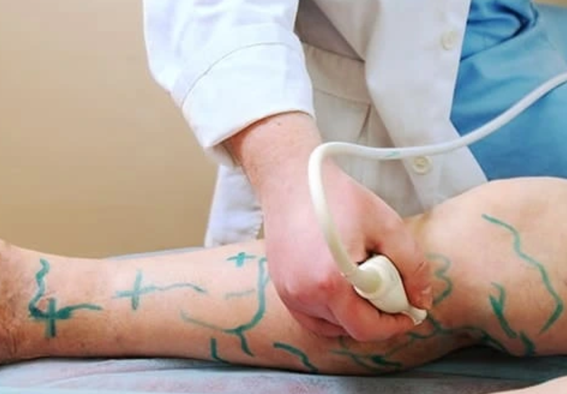 Vascular Surgery