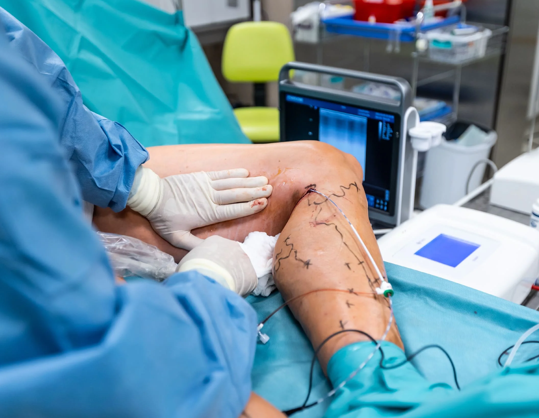Vascular Surgery