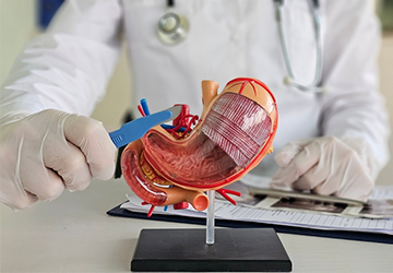 bariatric surgery