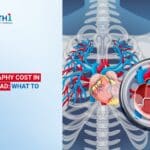 Angiography Cost in Ahmedabad
