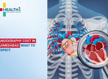 Angiography Cost in Ahmedabad