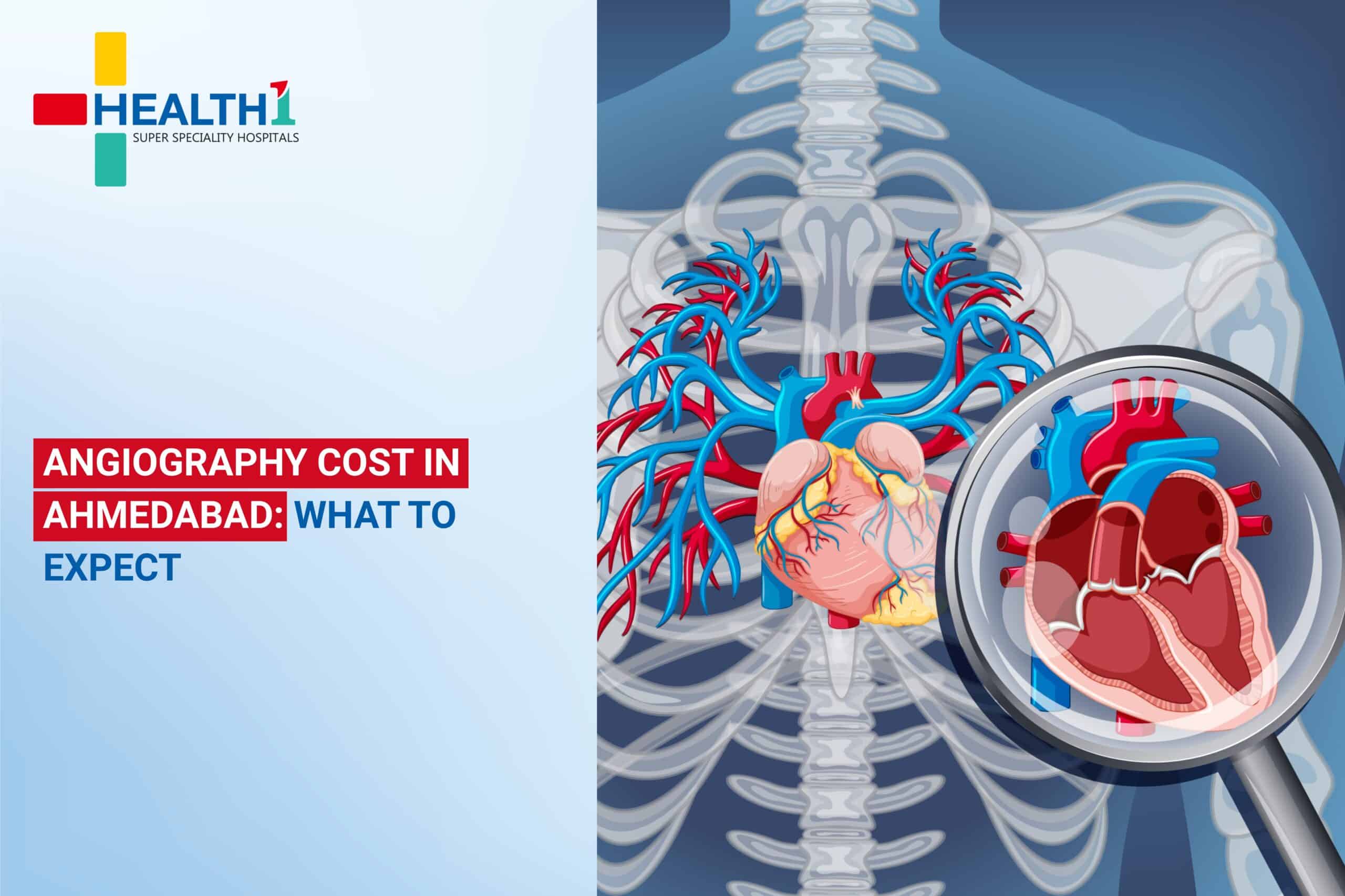 Angiography Cost in Ahmedabad
