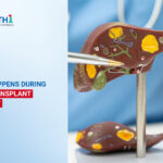 Liver Transplant Center in Ahmedabad