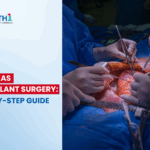 Pancreas Transplant Surgery