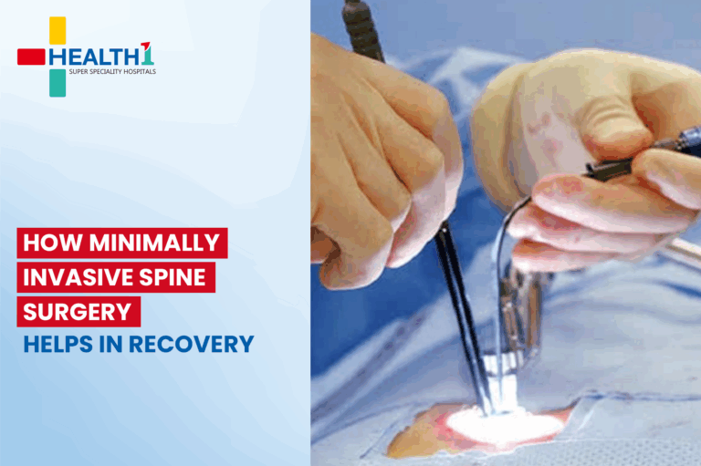 Spine Surgery Helps in Recovery