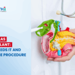 Pancreas Transplant: Who Needs It and How the Procedure Works
